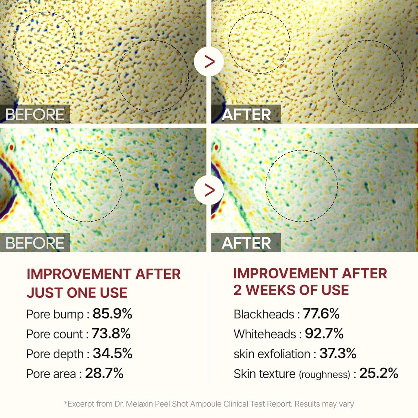 Dr.Melaxin Peel Shot Glow Black Rice Peeling Ampoule (80ml) | AHA, BHA & Rice Water for Gentle Exfoliation & Glowing Skin