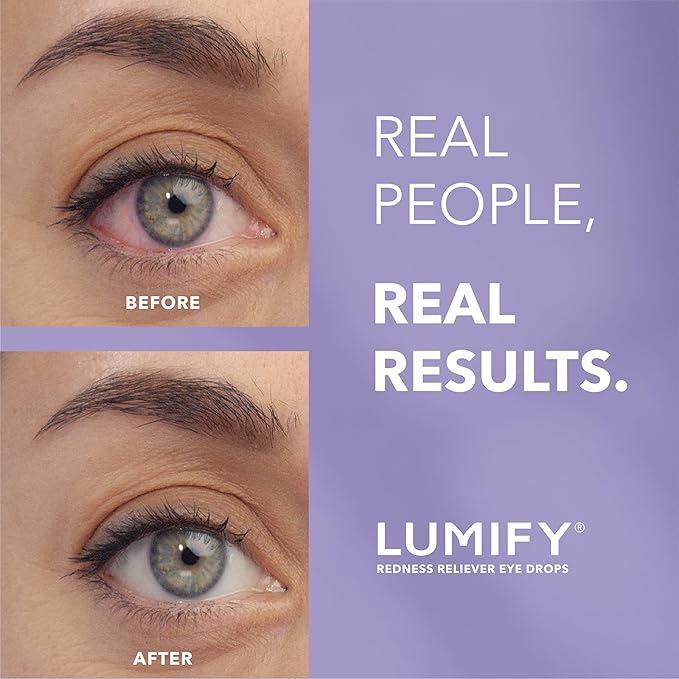 LUMIFY Eye Drops for Red Eyes, Redness Reliever for Brighter Looking Eyes, Works in 1 Minute & Lasts Up to 8 Hours, Eye Drops, 0.08 Fl Oz (2.5 mL)