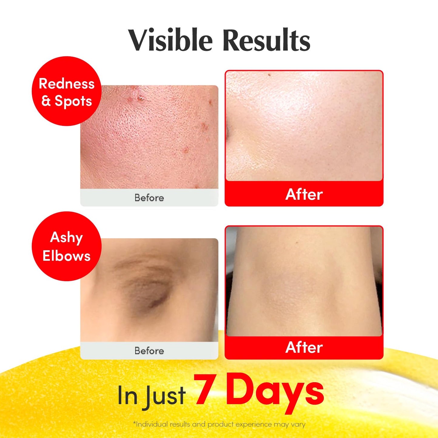 EQQUALBERRY Vitamin Illuminating Serum (30ml) | 4% Niacinamide + Vitamin C for Dark Spots & Glow